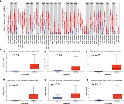 ASPM Is a Prognostic Biomarker and Correlates With Immune Infiltration in Kidney Renal Clear Cell Carcinoma and Liver Hepatocellular Carcinoma